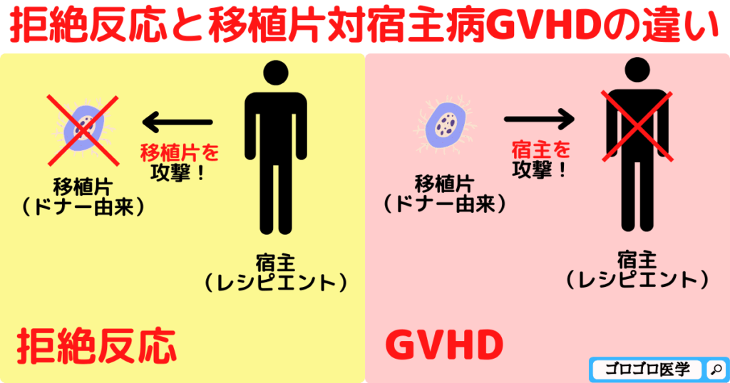 【急性-慢性腎移植】拒絶反応と移植片対宿主病GVHDの違い【覚え方・ゴロ】