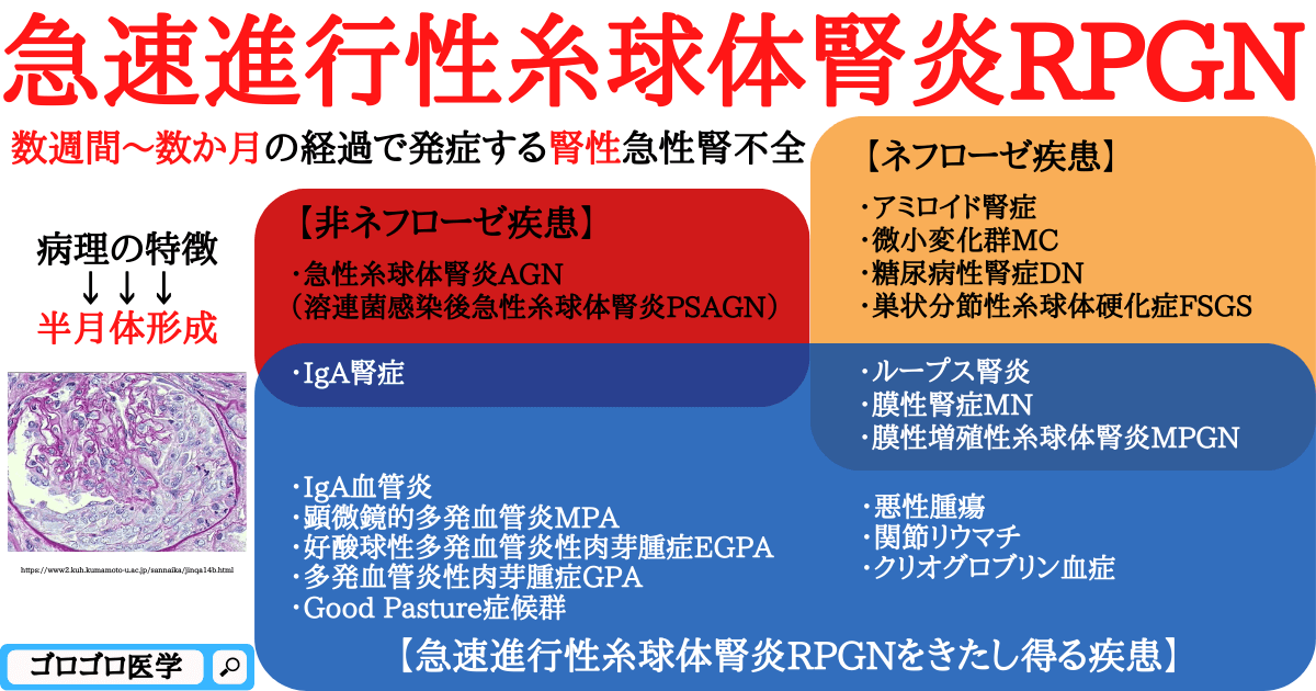 急速進行性糸球体腎炎RPGNの原因疾患の覚え方・ゴロ【CBT国試対策】 - ゴロゴロ医学