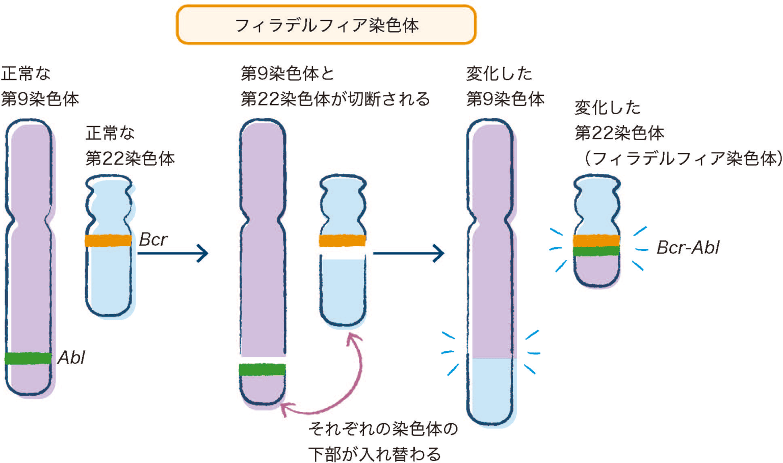 慢性骨髄性白血病の治療