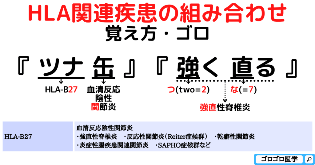 HLA-B27：強直性脊椎炎・反応性関節炎の覚え方・ゴロ