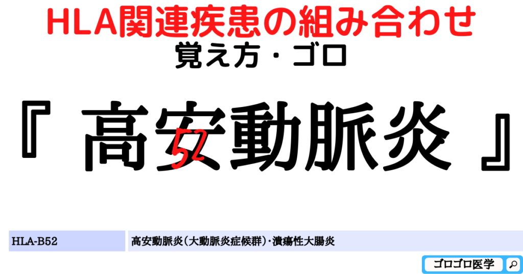 HLA-B52：高安動脈炎（大動脈炎症候群）の覚え方・ゴロ
