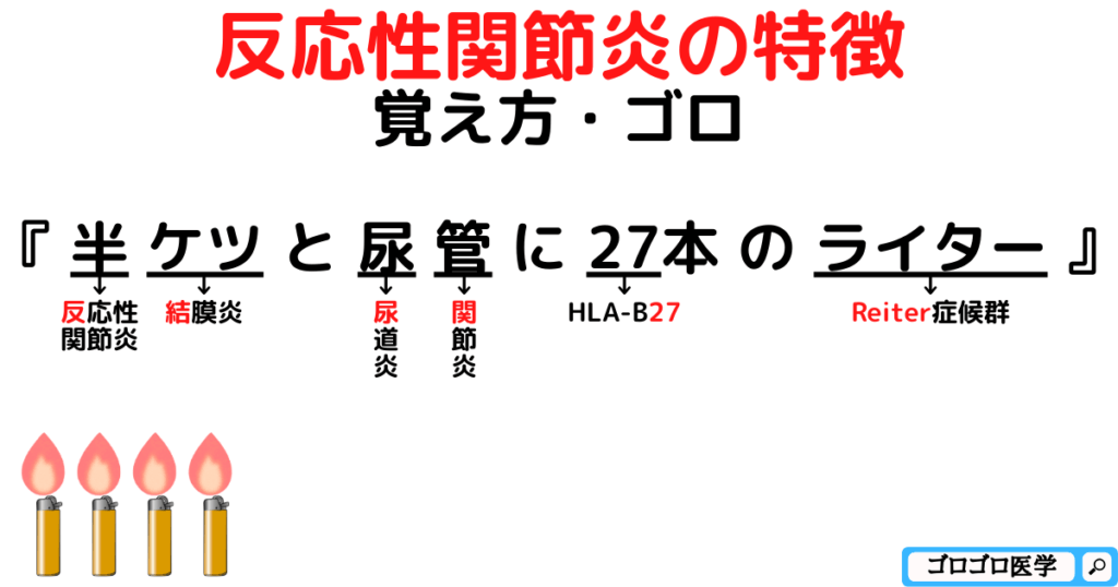 【3徴】反応性関節炎（Reiter症候群）の特徴の覚え方・ゴロ【CBT国家試験対策】