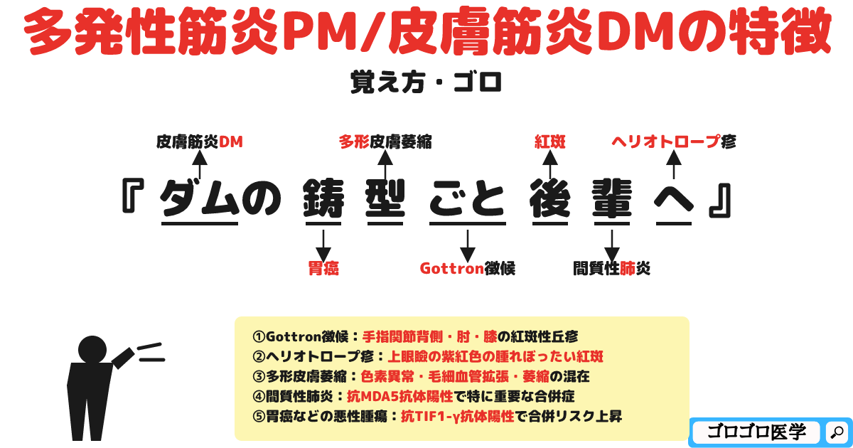 多発性筋炎PM/皮膚筋炎DMの特徴の覚え方・ゴロ【CBT国試対策】